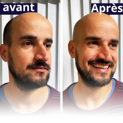 Rasage net et uniforme en moins de 2 minutes, sans coupures.